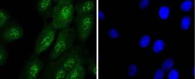 Immunocytochemistry/Immunofluorescence: Caspase-14 Antibody (JJ089-01) [NBP2-67877] - Staining Caspase-14 in A431 cells (green). The nuclear counter stain is DAPI (blue). Cells were fixed in paraformaldehyde, permeabilised with 0.25% Triton X100/PBS.