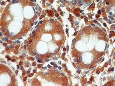 Analysis in normal colon stained 4ug/ml. Localization can be cytoplasmic and nuclear. Staining in the nucleus is considered to be an indication of active Caspase-3. In most cell types and model systems, cells with active Caspase-3 are undergoing apoptosis.