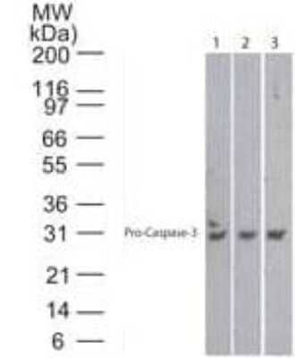 Lanes 1, 2 and 3 demonstrate the species cross-reactivity of the antibody in human, mouse and rat heart lysate, respectively.