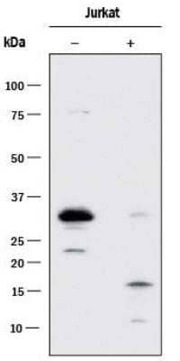 Lysates of Jurkat human acute T cell leukemia cell line untreated (-) or treated (+) with VP-16. PVDF membrane was probed with 0.1 ug/mL of mouse monoclonal Caspase-3 Antibody (31A1067) - (Pro and Active) (NB100-56708, Novus Biologicals) followed by 1:2000 dilution donkey anti-mouse IgG. Image using the standard format of this product.