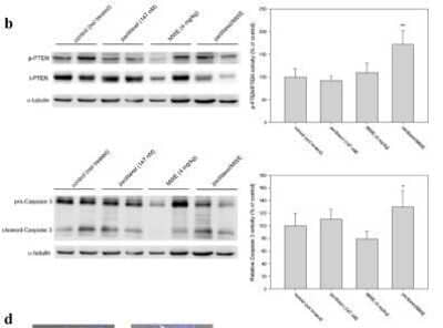 Paclitaxel in combination with MWE retarded tumor growth in a human bladder carcinoma TSGH 8301 xenograft model. The levels of total (t-PTEN) and phospho-PTEN (p-PTEN) and Caspase 3 in the tumor specimens were determined by Western blotting and then quantified using beta-actin as the protein loading control; the results are expressed as a percentage of the control. Image collected and cropped by CiteAb from the following publication (//www.nature.com/articles/srep20417), licensed under a CC-BY license. Image using the standard format of this product.