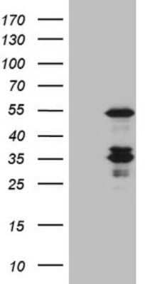 Western Blot: Caspase-4 Antibody (4A2) [NBP2-46065] - Analysis of HEK293T cells were transfected with the pCMV6-ENTRY control (Left lane) or pCMV6-ENTRY Caspase 4.