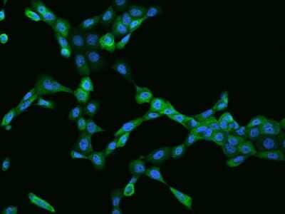 Immunocytochemistry/Immunofluorescence: Caspase-4 Antibody [NBP2-97308] - Immunofluorescence staining of Caspase-4 in A431 cells. Cells were fixed with 4% PFA, permeabilzed with 0.1% Triton X-100 in PBS, blocked with 10% serum, and incubated with rabbit anti-Human Caspase-4 polyclonal antibody (dilution ratio 1:200) at 4C overnight. Then cells were stained with the Alexa Fluor(R)488-conjugated Goat Anti-rabbit IgG Secondary antibody (green) and counterstained with DAPI (blue).Positive staining was localized to Cytoplasm.