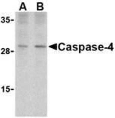 Western Blot: Caspase-4 Antibody [NBP1-77208] - Human spleen cells with caspase-4 antibody at (A) 1 and (B) 2 ug/ml.