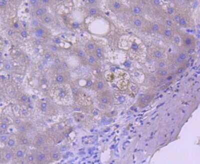 Immunohistochemistry-Paraffin: Caspase 5 Antibody (SD203-2) [NBP2-67757] - Analysis of paraffin-embedded human liver tissue using anti-Caspase 5 antibody. Counter stained with hematoxylin.