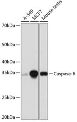 Western Blot: Caspase-6 Antibody (2W4G2) [NBP3-15775] - Western blot analysis of extracts of various cell lines, using Caspase-6 antibody (NBP3-15775) at 1:1000 dilution. Secondary antibody: HRP Goat Anti-Rabbit IgG (H+L) at 1:10000 dilution. Lysates/proteins: 25ug per lane. Blocking buffer: 3% nonfat dry milk in TBST. Detection: ECL Basic Kit. Exposure time: 3min.