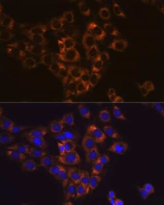 Immunocytochemistry/Immunofluorescence: Caspase-6 Antibody (6D7S2) [NBP3-15771] - Immunofluorescence analysis of C6 cells using Caspase-6 antibody (NBP3-15771). Blue: DAPI for nuclear staining.