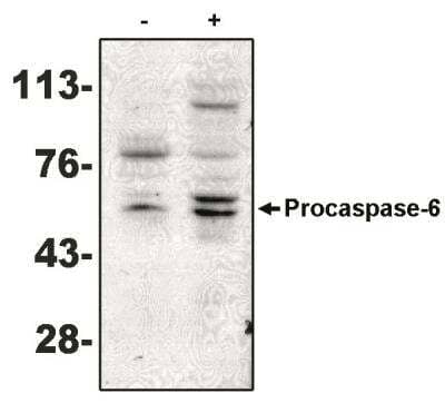 Western Blot: Caspase-6 Antibody (MCH2 14 1-190) [NBP2-66612] - Analysis using caspase-6 antibody on MCF-7 cells negative (-) and positive (+) for caspase-3 after treatment for 48 hours with thapsigargin.