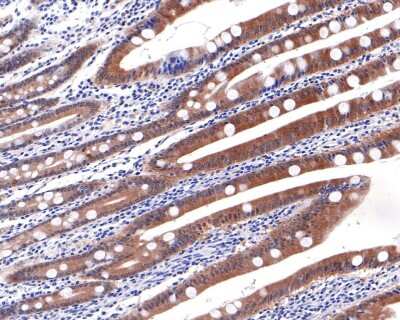 Immunohistochemistry-Paraffin: Caspase-6 Antibody (SC56-09) - (Pro and Active) [NBP2-67567] - Analysis of paraffin-embedded human small intestine tissue with Rabbit anti-Caspase-6 antibody washed with ddH2O and PBS, and then probed with the primary antibody  at 1/400 dilution for 1 hour at room temperature. The detection was performed using an HRP conjugated compact polymer system. DAB was used as the chromogen. Tissues were counterstained with hematoxylin and mounted with DPX.