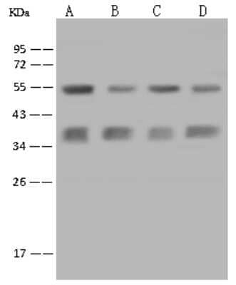 Western Blot: Caspase-6 Antibody [NBP2-99463] - Anti-Caspase-6 rabbit polyclonal antibody at 1:500 dilution. Lane A: SKBR-3 Whole Cell Lysate. Lane B: Hela Whole Cell Lysate. Lane C: LOVO Whole Cell Lysate. Lane D: PC-3 Whole Cell Lysate. Lysates/proteins at 30 ug per lane. Secondary Goat Anti-Rabbit IgG (H+L)/HRP at 1/10000 dilution. Developed using the ECL technique. Performed under reducing conditions. Predicted band size: 33 kDa. Observed band size: 37 kDa