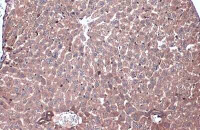 Immunohistochemistry-Paraffin: Caspase-6 Antibody - (cleaved) [NBP3-13380] - Caspase-6 (cleaved Asp162) antibody detects Caspase-6 (cleaved Asp162) protein at cytoplasm by immunohistochemical analysis. Sample: Paraffin-embedded mouse liver. Caspase-6 (cleaved Asp162) stained by Caspase-6 (cleaved Asp162) antibody (NBP3-13380) diluted at 1:1000. Antigen Retrieval: Citrate buffer, pH 6.0, 15 min