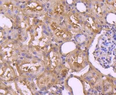 Immunohistochemistry-Paraffin: Caspase-7 Antibody (SD20-57) - Pro form [NBP2-67756] - Analysis of paraffin-embedded human kidney tissue using anti-pro Caspase 7 antibody. Counter stained with hematoxylin.