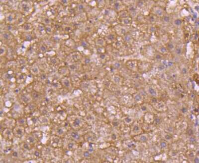 Immunohistochemistry-Paraffin: Caspase-7 Antibody (SD20-57) - Pro form [NBP2-67756] - Analysis of paraffin-embedded human liver tissue using anti-pro Caspase 7 antibody. Counter stained with hematoxylin.