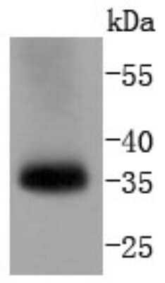Western Blot: Caspase-7 Antibody (SD20-57) - Pro form [NBP2-67756] - Analysis of pro Caspase 7 on human lung lysates using anti-pro Caspase 7 antibody at 1/1,000 dilution.