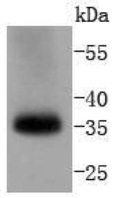 Western Blot: Caspase-7 Antibody (SD20-57) - Pro form [NBP2-67756] - Western blot analysis of Caspase-7 on human lung lysates using anti-Caspase-7 antibody at 1/1,000 dilution.