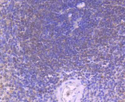 Immunohistochemistry-Paraffin: Caspase-8 Antibody (SD08-06) - Pro form [NBP2-67803] - Analysis of paraffin-embedded human spleen tissue using anti-Caspase-8 antibody. Counter stained with hematoxylin.
