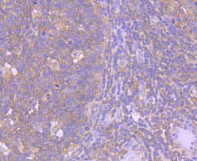 Immunohistochemistry-Paraffin: Caspase-8 Antibody (SD08-06) - Pro form [NBP2-67803] - Analysis of paraffin-embedded human tonsil tissue using anti-Caspase-8 antibody. Counter stained with hematoxylin.
