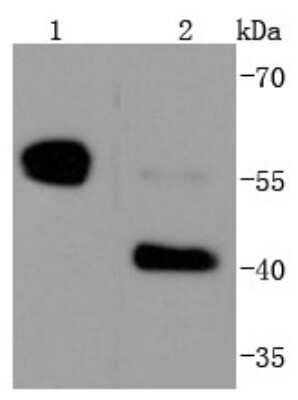 Western Blot: Caspase-8 Antibody (SD08-06) - Pro form [NBP2-67803] - Analysis of Caspase-8 on different lysates using anti-Caspase-8 antibody at 1/1,000 dilution. Positive control: Lane 1: Jurkat Lane 2: Hela