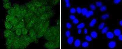 Immunocytochemistry/Immunofluorescence: Caspase-8 Antibody (SZ01-08) - Pro form [NBP2-67355] - Staining Caspase-8 in HepG2 cells (green). The nuclear counter stain is DAPI (blue). Cells were fixed in paraformaldehyde, permeabilised with 0.25% Triton X100/PBS.
