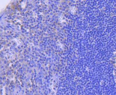 Immunohistochemistry-Paraffin: Caspase-8 Antibody (SZ01-08) - Pro form [NBP2-67355] - Analysis of paraffin-embedded human tonsil tissue using anti-Caspase-8 antibody. Counter stained with hematoxylin.