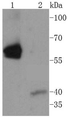 Western Blot: Caspase-8 Antibody (SZ01-08) - Pro form [NBP2-67355] - Analysis of Caspase-8 on different lysates using anti-Caspase-8 antibody at 1/1,000 dilution. Positive control: Lane 1: Jurkat Lane 2: Hela