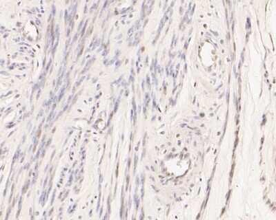Immunohistochemistry-Paraffin: Caspase-9 Antibody (JJ08-05) - Pro form [NBP2-67848] - Immunohistochemical analysis of paraffin-embedded human cervix uteri tissue using anti-pro Caspase-9 antibody. The section was pre-treated using heat mediated antigen retrieval with sodium citrate buffer (pH 6.0) for 20 minutes. The tissues were blocked in 5% BSA for 30 minutes at room temperature, washed with ddH2O and PBS, and then probed with the primary antibody (1/100) for 30 minutes at room temperature. The detection was performed using an HRP conjugated compact polymer system. DAB was used as the chromogen. Tissues were counterstained with hematoxylin and mounted with DPX.