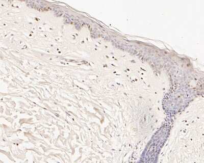 Immunohistochemistry-Paraffin: Caspase-9 Antibody (JJ08-05) - Pro form [NBP2-67848] - Immunohistochemical analysis of paraffin-embedded human skin tissue using anti-pro Caspase-9 antibody. The section was pre-treated using heat mediated antigen retrieval with sodium citrate buffer (pH 6.0) for 20 minutes. The tissues were blocked in 5% BSA for 30 minutes at room temperature, washed with ddH2O and PBS, and then probed with the primary antibody (1/100) for 30 minutes at room temperature. The detection was performed using an HRP conjugated compact polymer system. DAB was used as the chromogen. Tissues were counterstained with hematoxylin and mounted with DPX.