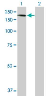 Western Blot: Caspr2 Antibody [H00026047-D01P] - Analysis of CNTNAP2 expression in transfected 293T cell line by CNTNAP2 polyclonal antibody.Lane 1: CNTNAP2 transfected lysate(148.20 KDa).Lane 2: Non-transfected lysate.
