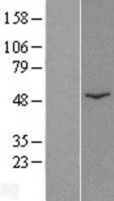 Western Blot: CatSper2 Overexpression Lysate (Adult Normal) [NBP2-05819] Left-Empty vector transfected control cell lysate (HEK293 cell lysate); Right -Over-expression Lysate for CatSper2.
