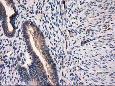 Immunohistochemistry-Paraffin: Catalase Antibody (1B8) [NBP2-00492] - Staining of paraffin-embedded Human endometrium tissue using anti-Catalase mouse monoclonal antibody.