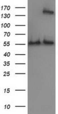 Western Blot: Catalase Antibody (1B8) [NBP2-00492] - HEK293T cells were transfected with the pCMV6-ENTRY control (Left lane) or pCMV6-ENTRY Catalase (Right lane) cDNA for 48 hrs and lysed. Equivalent amounts of cell lysates (5 ug per lane) were separated by SDS-PAGE and immunoblotted with anti-Catalase.