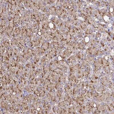 Immunohistochemistry: Catalase Antibody [NBP2-38772] - Staining of human liver shows strong cytoplasmic positivity in hepatocytes.