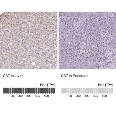 Immunohistochemistry-Paraffin: Catalase Antibody [NBP2-38646] - Staining in human liver and pancreas tissues using anti-CAT antibody. Corresponding CAT RNA-seq data are presented for the same tissues.