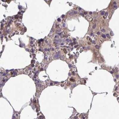 Immunohistochemistry-Paraffin: Catalase Antibody [NBP2-38772] - Staining of human bone marrow.