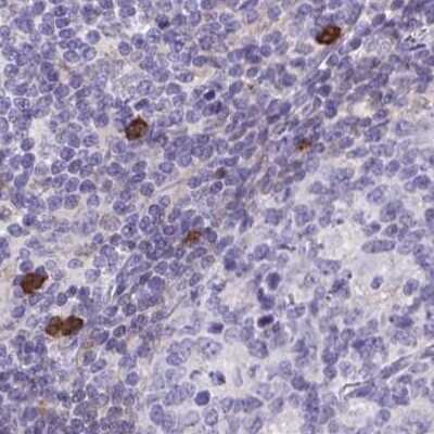 Immunohistochemistry-Paraffin: Catalase Antibody [NBP2-38772] - Staining of human lymph node.