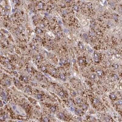 Immunohistochemistry-Paraffin: Catalase Antibody [NBP2-38772] - Staining of human liver using Anti-CAT antibody NBP2-38772.