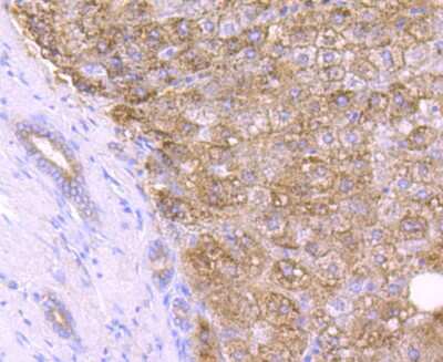 Immunohistochemistry-Paraffin: Catalase Antibody (JM11-12) [NBP2-67212] - Analysis of paraffin-embedded human liver tissue using anti-Catalase antibody. Counter stained with hematoxylin.