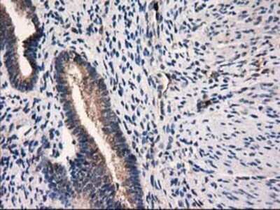 Immunohistochemistry: Catalase Antibody (OTI1B8) - Azide and BSA Free [NBP2-70342] - Staining of paraffin-embedded Human endometrium tissue using anti-Catalase mouse monoclonal antibody.