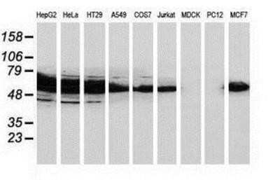 Western Blot: Catalase Antibody (OTI1B8) - Azide and BSA Free [NBP2-70342] - Analysis of extracts (35ug) from 9 different cell lines by using anti-Catalase monoclonal antibody.