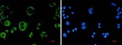 Immunocytochemistry/Immunofluorescence: Catalase Antibody (S03-8E9) [NBP3-14914] - Immunofluorescence of Catalase (green) in Raw264. 7 using Catalase antibody at dilution 1/50, and DAPI (blue)