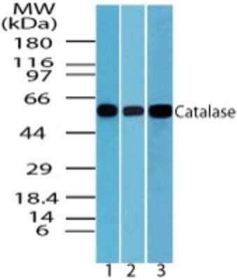 Western Blot: Catalase Antibody [NBP2-24916] - Analysis in liver lysate of 1) human 2) mouse and 3) rat at 0.1 ug/ml.