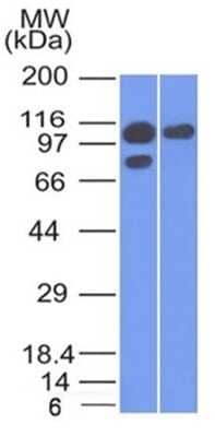 Western Blot: Catenin alpha 1 Antibody (1G5) - Azide and BSA Free [NBP2-54533] - Western Blot of A431 and MCF-7 cell lysate using Catenin alpha 1 Antibody (1G5).