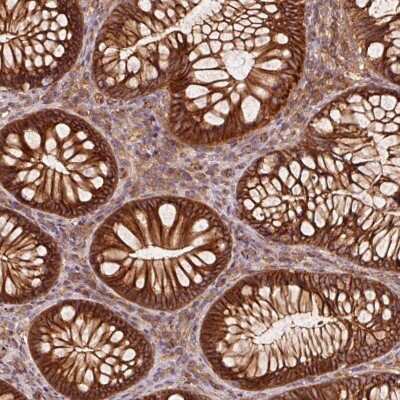 Immunohistochemistry: Catenin alpha 1 Antibody [NBP2-33456] - Staining of human colon shows strong cytoplasmic and membranous positivity in glandular cells.