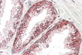 Immunohistochemistry-Paraffin: Catenin alpha 1 Antibody [NB100-2917] - Staining of paraffin embedded human prostate. Image shows staining of cell membranes of the secretory cells in the glands. Antibody at 3.8 ug/mL. Steamed antigen retrieval with citrate buffer pH 6, AP-staining.