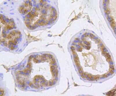 Immunohistochemistry-Paraffin: Catenin alpha 1 Antibody (SC0619) [NBP2-67588] - Analysis of paraffin-embedded mouse prostate tissue using anti-alpha 1 Catenin antibody. Counter stained with hematoxylin.