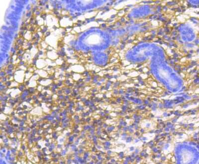 Immunohistochemistry-Paraffin: Catenin alpha 1 Antibody (SC0619) [NBP2-67588] - Analysis of paraffin-embedded mouse uterus tissue using anti-alpha 1 Catenin antibody. Counter stained with hematoxylin.