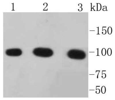 Western Blot: Catenin alpha 1 Antibody (SC0619) [NBP2-67588] - Analysis of alpha 1 Catenin on different lysates using anti-alpha 1 Catenin antibody at 1/1,000 dilution. Positive control: Lane 1: Hela Lane 2: HepG2 Lane 3: A431