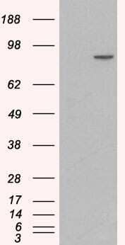 Western Blot: Catenin alpha 1 Antibody [NB100-2917] - HEK293 overexpressing Human CTNNA1 and probed with (mock transfection in first lane).