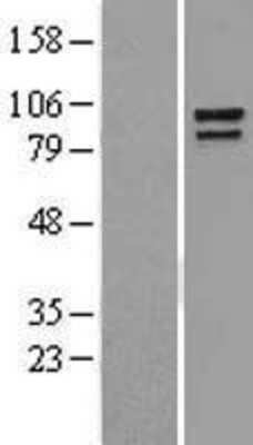 Western Blot Catenin alpha 1 Overexpression Lysate