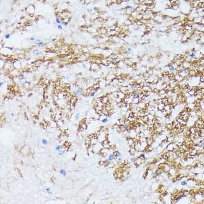 Immunohistochemistry-Paraffin Catenin alpha 2 Antibody - Azide and BSA Free